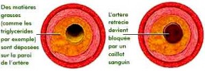 triglycerides-consequences